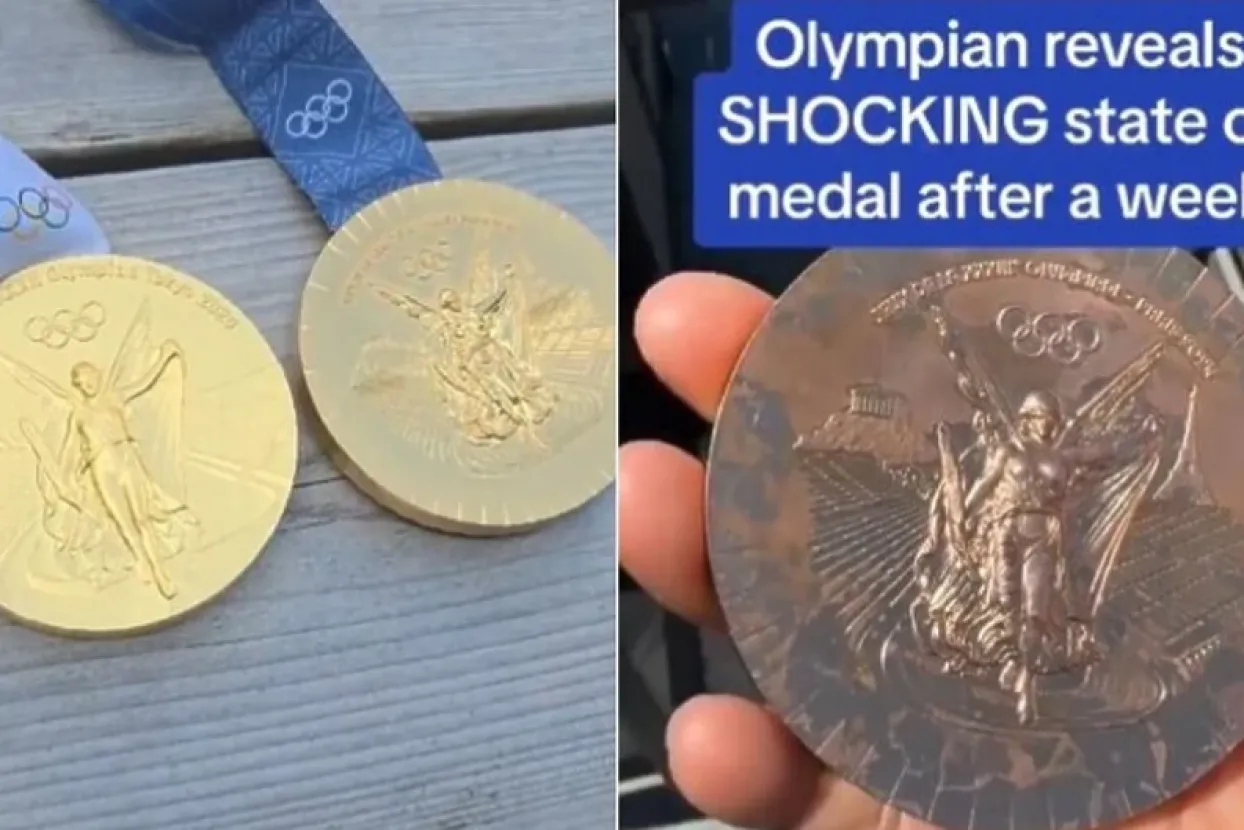 Očajna kvaliteta medalja iz Pariza